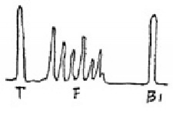 超聲檢測(cè)中常見(jiàn)缺陷的波形的圖文介紹